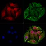 NSUN2 Antibody in Immunocytochemistry (ICC/IF)