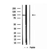 NSUN2 Antibody in Western Blot (WB)