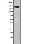 NUP214 Antibody in Western Blot (WB)