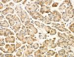 OSBP Antibody in Immunohistochemistry (Paraffin) (IHC (P))