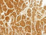 OSBP Antibody in Immunohistochemistry (Paraffin) (IHC (P))