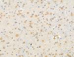 OSBP Antibody in Immunohistochemistry (Paraffin) (IHC (P))