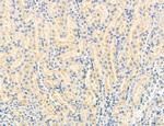 OSBP Antibody in Immunohistochemistry (Paraffin) (IHC (P))