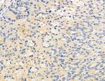 OSBP Antibody in Immunohistochemistry (Paraffin) (IHC (P))