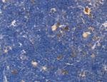 OSBP Antibody in Immunohistochemistry (Paraffin) (IHC (P))