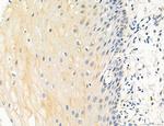 OSBP Antibody in Immunohistochemistry (Paraffin) (IHC (P))