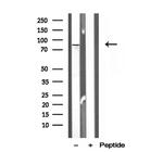 OSBP Antibody in Western Blot (WB)