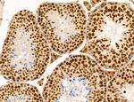 SP7 Antibody in Immunohistochemistry (Paraffin) (IHC (P))