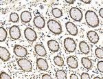 SP7 Antibody in Immunohistochemistry (Paraffin) (IHC (P))