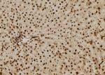 p14ARF Antibody in Immunohistochemistry (Paraffin) (IHC (P))