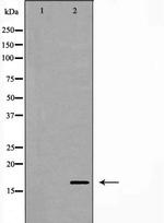 p14ARF Antibody in Western Blot (WB)