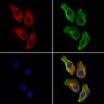 P2X2 Antibody in Immunocytochemistry (ICC/IF)