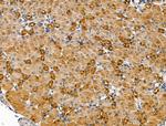 P2X2 Antibody in Immunohistochemistry (Paraffin) (IHC (P))