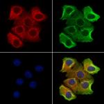 P2X3 Antibody in Immunocytochemistry (ICC/IF)