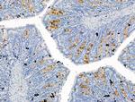 P2X3 Antibody in Immunohistochemistry (Paraffin) (IHC (P))