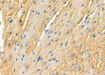 P4HTM Antibody in Immunohistochemistry (Paraffin) (IHC (P))