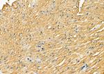 P4HTM Antibody in Immunohistochemistry (Paraffin) (IHC (P))