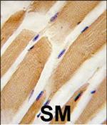 Actin Antibody in Immunohistochemistry (Paraffin) (IHC (P))