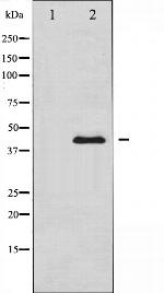 PAI1 Antibody in Western Blot (WB)