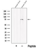 PCK2 Antibody in Western Blot (WB)