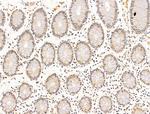 PDE1C Antibody in Immunohistochemistry (Paraffin) (IHC (P))