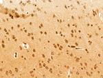 PDE1C Antibody in Immunohistochemistry (Paraffin) (IHC (P))