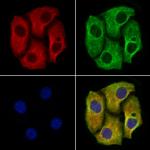 PDE4A Antibody in Immunocytochemistry (ICC/IF)