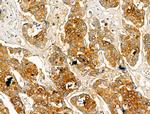 Pericentrin Antibody in Immunohistochemistry (Paraffin) (IHC (P))