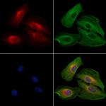 PERK Antibody in Immunocytochemistry (ICC/IF)