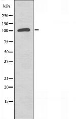 PERK Antibody in Western Blot (WB)