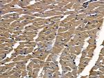 PERP Antibody in Immunohistochemistry (Paraffin) (IHC (P))