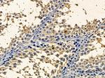 PEX3 Antibody in Immunohistochemistry (Paraffin) (IHC (P))