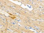 PGAM5 Antibody in Immunohistochemistry (Paraffin) (IHC (P))