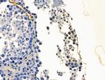 PHF8 Antibody in Immunohistochemistry (Paraffin) (IHC (P))