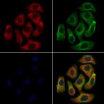 Phospholamban Antibody in Immunocytochemistry (ICC/IF)