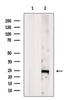 Phospholamban Antibody in Western Blot (WB)