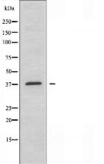 PKA alpha Antibody in Western Blot (WB)