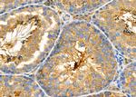 PKA C alpha/beta Antibody in Immunohistochemistry (Paraffin) (IHC (P))