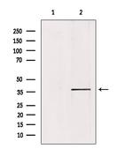 PKA C alpha/beta Antibody in Western Blot (WB)