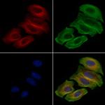 PKC mu Antibody in Immunocytochemistry (ICC/IF)