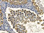 PNPase Antibody in Immunohistochemistry (Paraffin) (IHC (P))