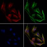 PON1 Antibody in Immunocytochemistry (ICC/IF)