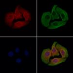 PP2C beta Antibody in Immunocytochemistry (ICC/IF)