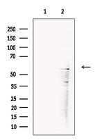 PP2C beta Antibody in Western Blot (WB)