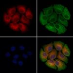 PF4 Antibody in Immunocytochemistry (ICC/IF)