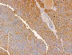 PF4 Antibody in Immunohistochemistry (Paraffin) (IHC (P))