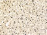 PPP1R2 Antibody in Immunohistochemistry (Paraffin) (IHC (P))