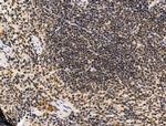 PPP1R2 Antibody in Immunohistochemistry (Paraffin) (IHC (P))