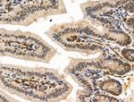 PPP1R2 Antibody in Immunohistochemistry (Paraffin) (IHC (P))