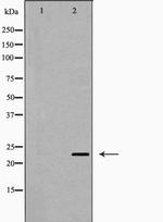 PPP1R2 Antibody in Western Blot (WB)